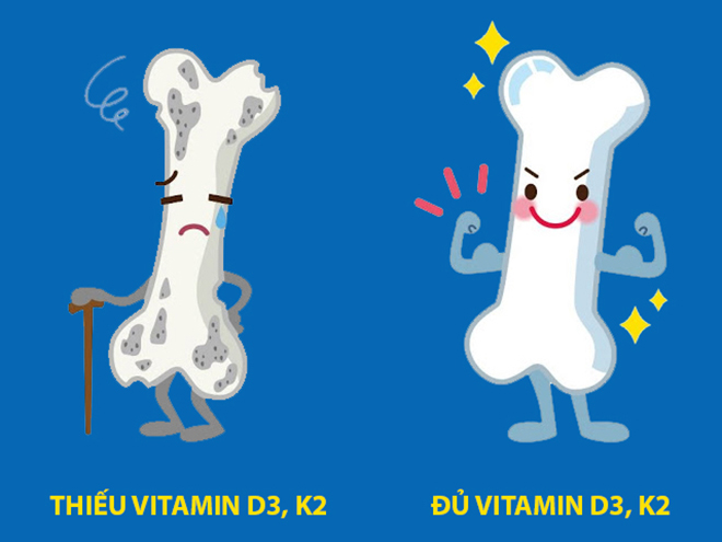 4 nhóm đối tượng cần bổ sung ngay vitamin K2 nếu muốn “xương chắc, chiều cao vượt trội” - 3