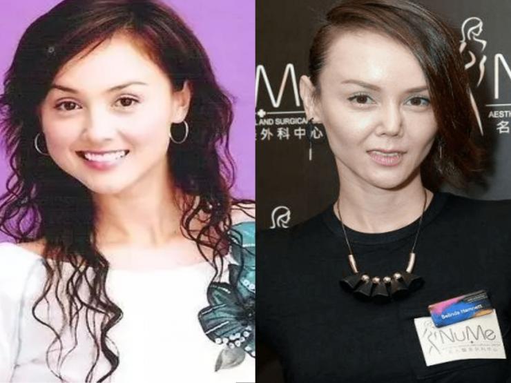 Đời sống Showbiz - “Hoa hậu Châu Á” mất hết vì chiếc mũi biến dạng, phải tuyên bố phá sản đã thảm hơn người này?