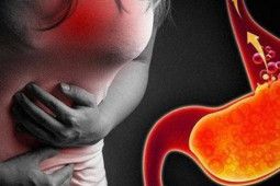 Sức khỏe đời sống - 6 dấu hiệu bệnh trào ngược dạ dày thực quản rất dễ nhầm với bệnh khác, chuyên gia khuyến cáo nên dừng việc này