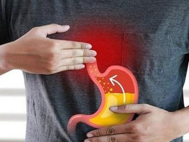 Sức khỏe đời sống - Bệnh trào ngược dạ dày thực quản có thể dẫn đến ung thư thực quản không?