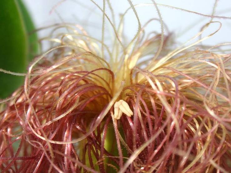 Sức khỏe đời sống - Nam giới bị viêm tuyến tiền liệt nhớ ăn 4 “món”, làm 2 "việc" này để giải độc, tiêu viêm