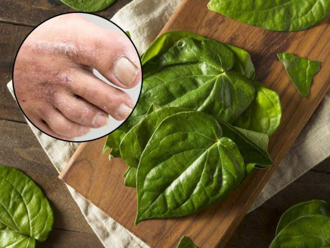 Betel leaves are not good at disinfecting, but using this way is prone to unpredictable harm - 2