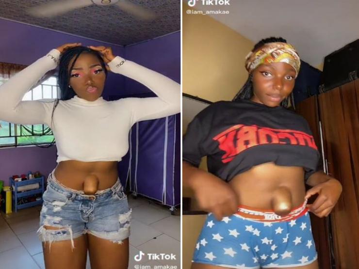 Bạn trẻ - Cuộc sống - Clip: Cô gái tự tin sở hữu chiếc rốn lồi “khổng lồ”