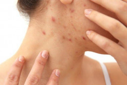 Sức khỏe đời sống - 5 dấu hiệu cho thấy độc tố đang âm thầm tích tụ trong cơ thể của bạn, giải độc ngay trước khi quá muộn