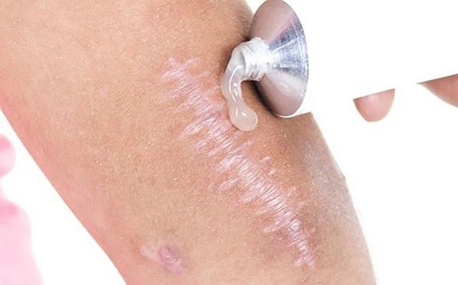 Sản phẩm kém chất lượng có thể gây ảnh hưởng cho làn da