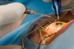 Sức khỏe đời sống - Lịch sử điều trị đục thủy tinh thể - phương pháp mang lại ánh sáng cho người mù lòa