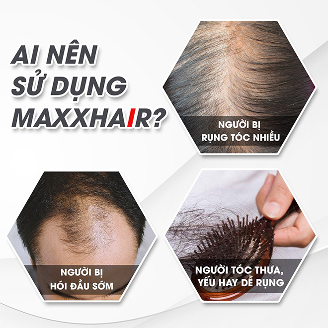 Maxxhair có thể dùng cho các trường hợp trên
