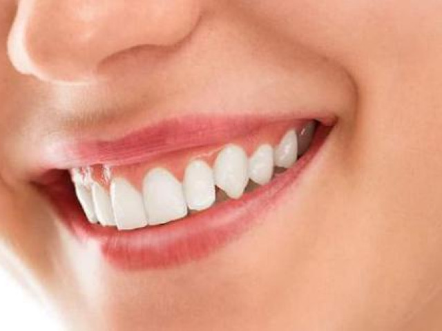 Làm đẹp - 5 biện pháp làm trắng răng tại nhà