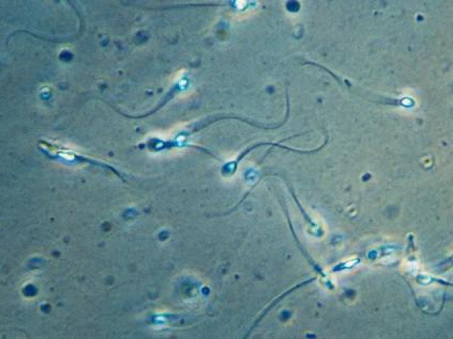 Sức khỏe đời sống - Giảm cân giúp quý ông tăng gấp đôi số lượng tinh trùng