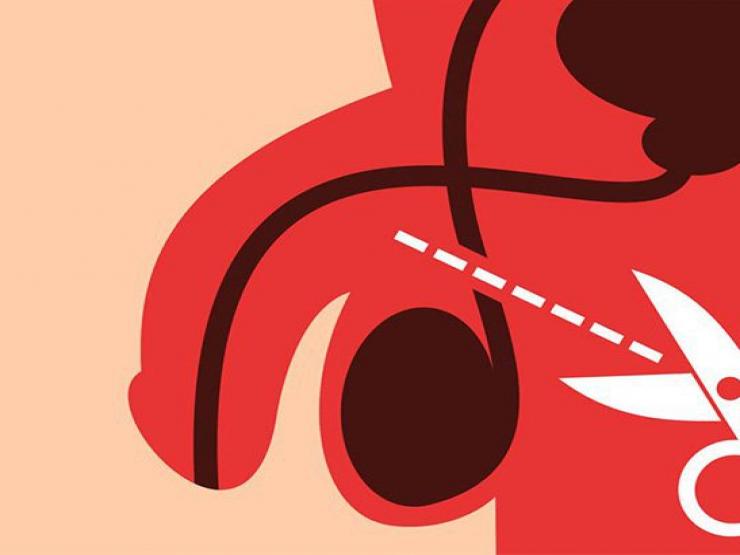 Sức khỏe đời sống - Lịch sử ra đời phương pháp thắt ống dẫn tinh