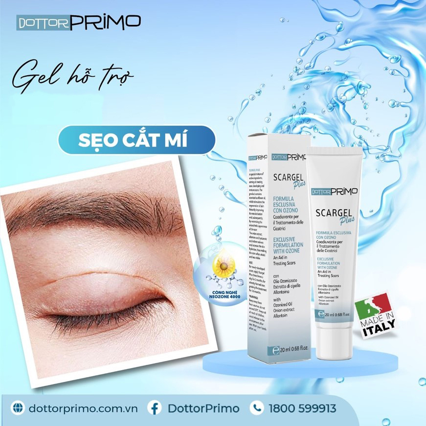 Sẹo cắt mí liệu có thực sự lành hẳn? - 1