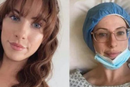 Sức khỏe đời sống - Phát hiện ung thư vú chỉ từ vết mụn trên ngực, cô gái 24 tuổi sốc