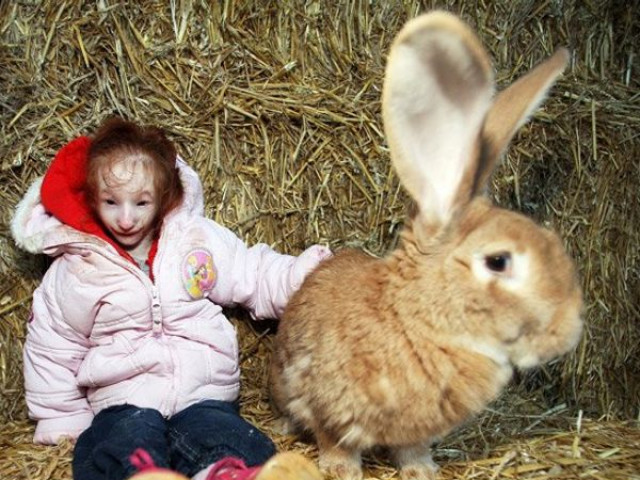 Bạn trẻ - Cuộc sống - Xúc động trước nghị lực sống của "bé gái nhỏ nhất thế giới"