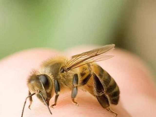 Sức khỏe đời sống - Ra vườn chơi, bé gái 18 tháng tuổi bị đàn ong mật đốt gần 50 nốt