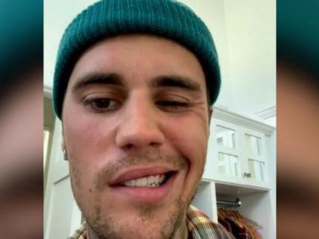 Sức khỏe đời sống - Ca sĩ Justin Bieber phải hủy 2 chuyến lưu diễn do mắc phải bệnh hiếm gặp