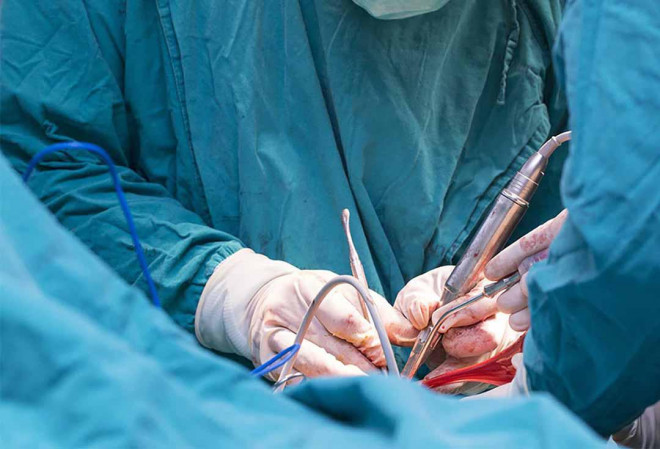 Phẫu thuật cắt bỏ tuyến tiền liệt có thể gây đau khi xuất tinh