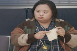 Sức khỏe đời sống - Nữ diễn viên phim "Our Blues" mắc hội chứng Down, triệu chứng bệnh thế nào?