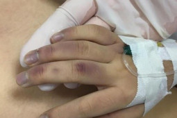 Pháp luật - Bố đánh con gái 6 tuổi tử vong