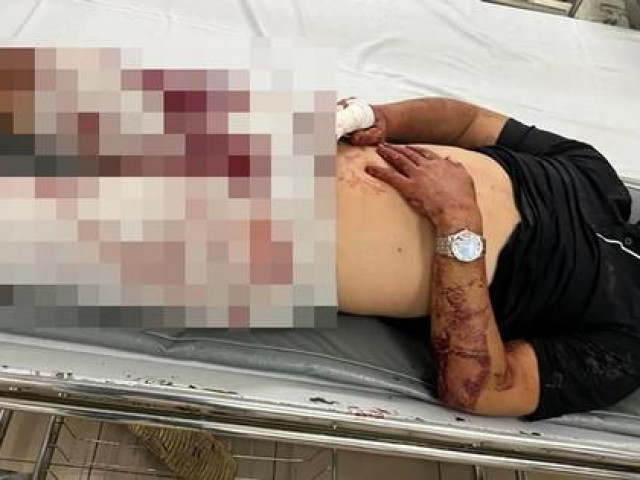 Pháp luật - Mâu thuẫn với tiếp viên, khách bị đánh bất tỉnh tại quán karaoke ở TP Thủ Đức