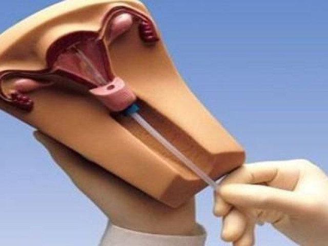 Sức khỏe đời sống - Lý giải 6 băn khoăn thường gặp về "chuyện ấy" khi phụ nữ đặt vòng tránh thai