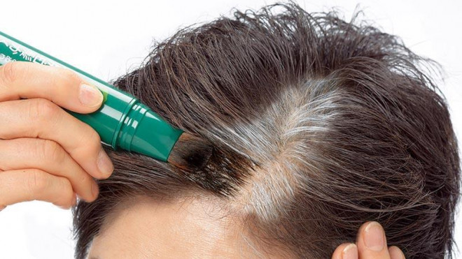 Thực hư tin đồn người tóc bạc ít bị ung thư, vị trí tóc bạc sẽ báo hiệu những bệnh gì liên quan - 2