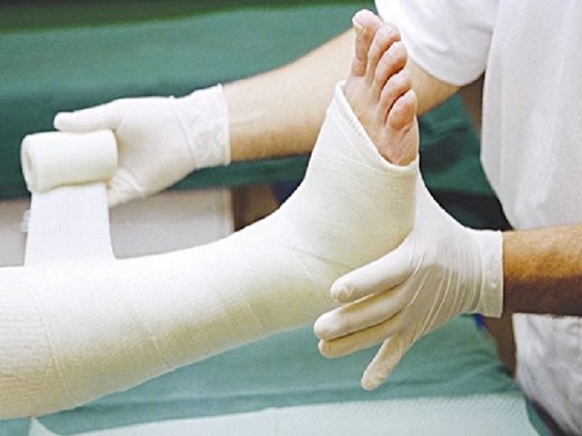 Phương pháp bó bột ra đời mang lại niềm hi vọng lớn đối với những bệnh nhân điều trị gãy xương
