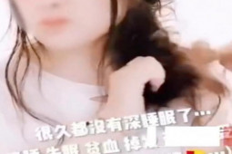 Bạn trẻ - Cuộc sống - 3 tháng không gội đầu vì sợ bị hói, cô gái cầu cứu dân mạng vì gặp rắc rối lớn