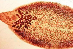 Sức khỏe đời sống - Bé trai 6 tuổi khám sức khỏe phát hiện "bệnh sán lá gan", ai cũng bất ngờ khi biết nguyên nhân