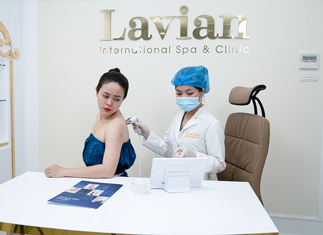Thẩm mỹ viện quốc tế Lavian - điểm đến tin tưởng trị viêm nang lông - 4