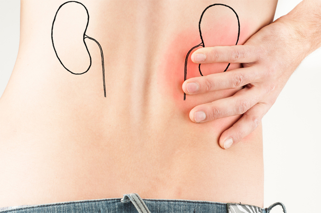 Đau ngang thắt lưng có thể là triệu chứng của bệnh suy thận độ 3