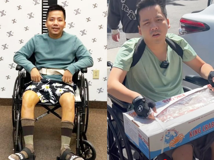 Đời sống Showbiz - Khoa Pug xuất viện sau khi chi 5 tỷ kéo chân, mở tiệc ăn mừng vì cao lên "chút xíu"