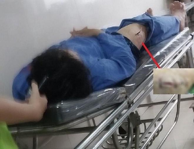 Thời điểm ông G. bị thương được đưa đi cấp cứu tại bệnh viện