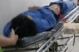 An ninh - Xã hội - Lời khai bất ngờ của kẻ rút dao đâm cán bộ Thuế