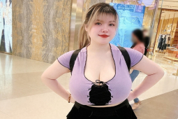 Làm đẹp - "Nữ sinh Hải Dương" giờ ra sao sau khi phẫu thuật thu gọn vòng 1?