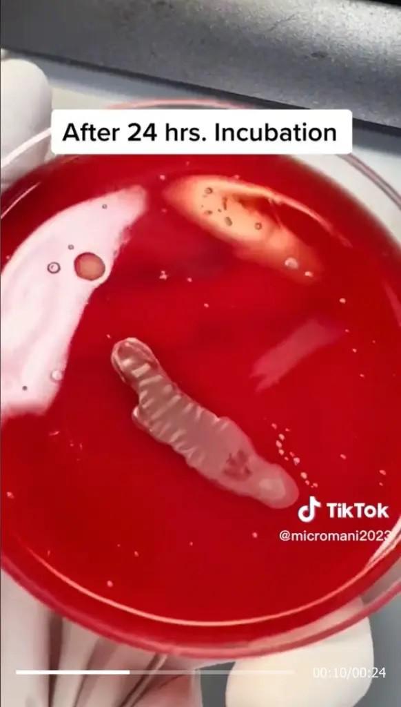 Các thí nghiệm của Abdlrasul được quay video và chia sẻ trên TikTok cho thấy sự phát triển của các vi khuẩn trên các vật dụng sinh hoạt hàng ngày.