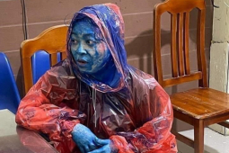 Tin tức trong ngày - Người phụ nữ bị tạt sơn kín mặt, công an vào cuộc điều tra