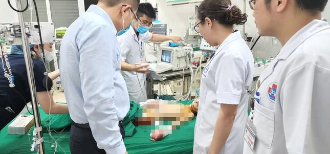 Hiện 3 con của anh Nhâm đang được điều trị tại 2 bệnh viện ở Nghệ An. Trong đó con gái 8 tuổi bị cắt cụt 1 bàn tay, 2 ngón ở bàn tay còn lại cũng phải tháo.