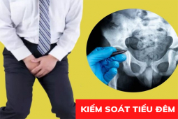 Sức khỏe đời sống - Cảnh báo: Tiểu đêm đột quỵ ở người trên 40 tuổi - xem chuyên gia tư vấn mẹo giảm tiểu đêm