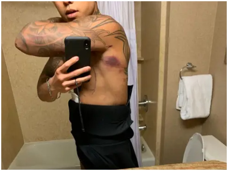 Sau khi làm phẫu thuật xong, người đàn ông phải chịu đựng sự đau đớn vật vã trong mấy ngày liền.