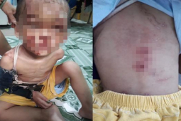 Pháp luật - Cha mẹ ruột trong vụ bé trai bị bạo hành âm tính với ma túy