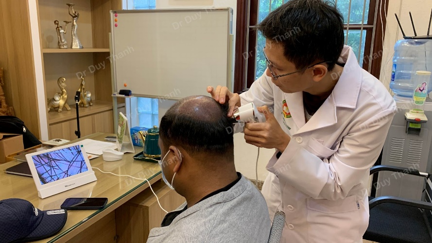 Dr Duy Thành thăm khám và tư vấn cụ thể cho bệnh nhân cấy tóc