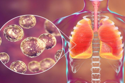 Sức khỏe đời sống - Căn bệnh nguy hiểm có dấu hiệu và biểu hiện cực giống cảm lạnh, cần hết sức lưu ý