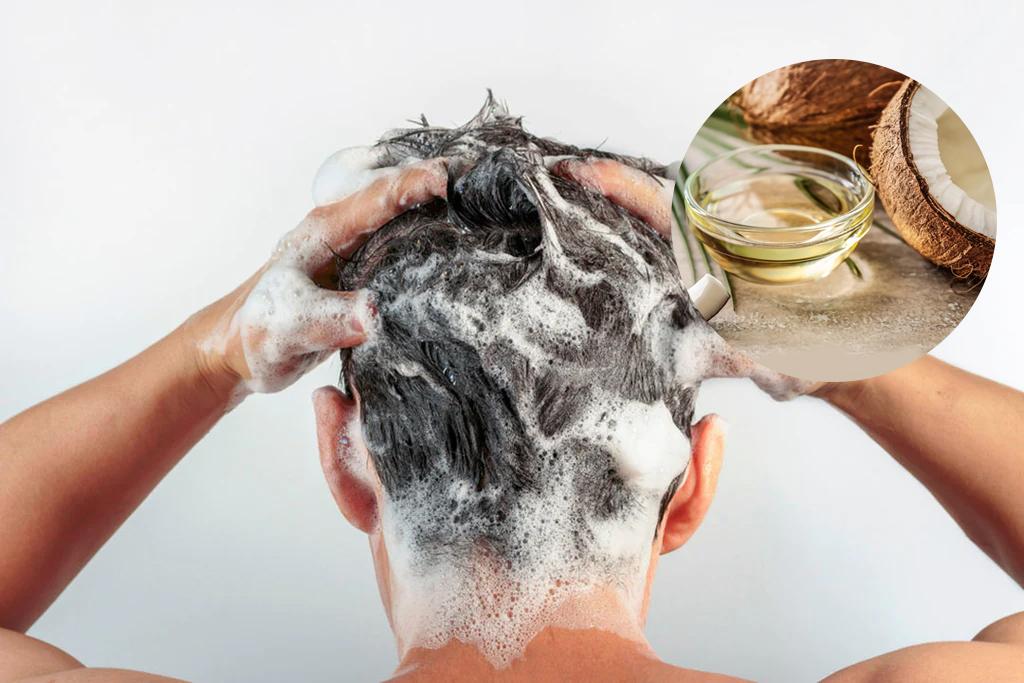 Dầu dừa giúp giảm gàu trên da đầu