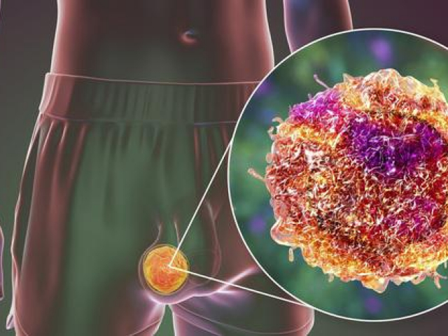 Sức khỏe đời sống - 10 giải đáp thú vị về tinh hoàn