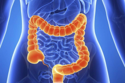 Sức khỏe đời sống - 6 tổn thương tiền ung thư nhất định phải phát hiện và điều trị kịp thời