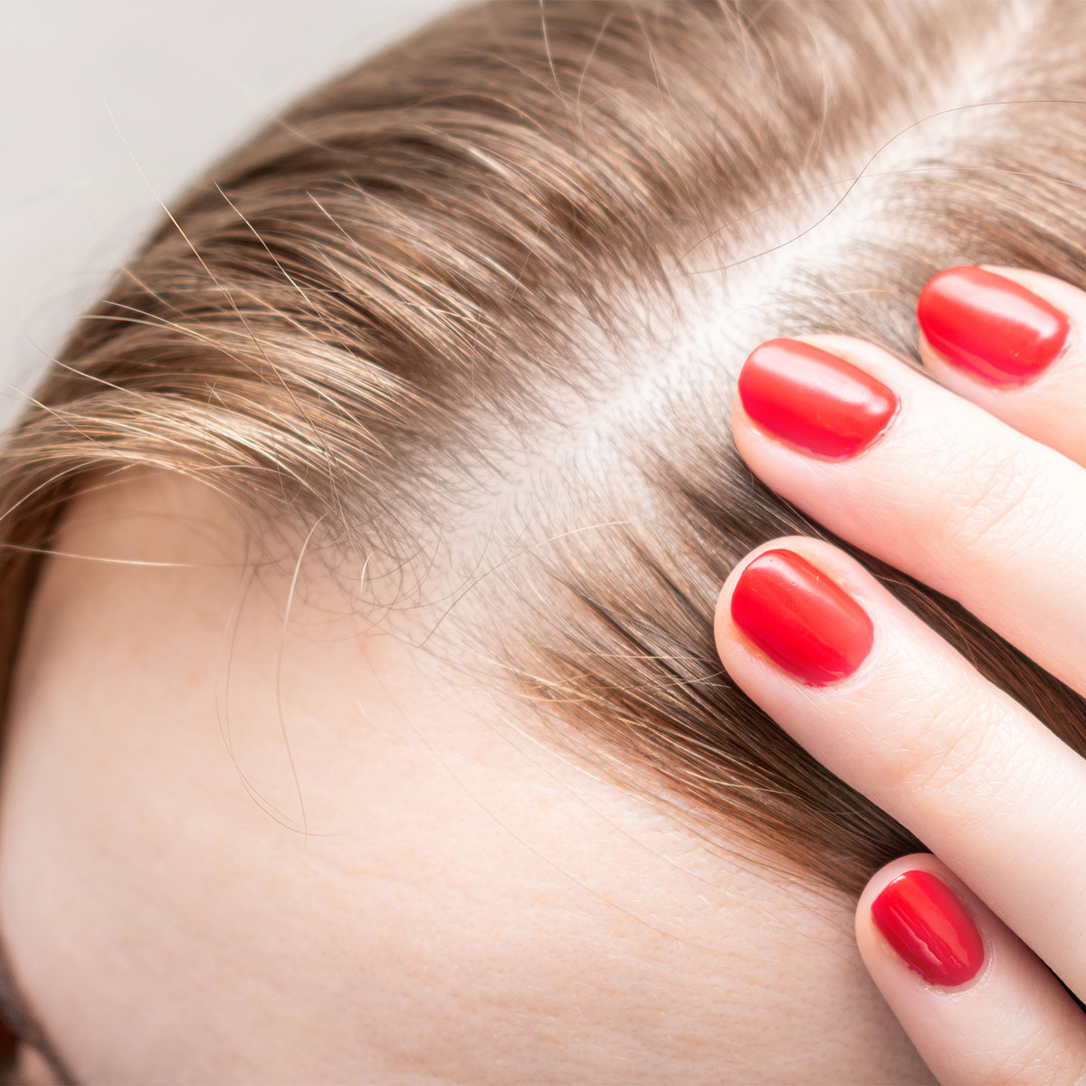 Ăn kẹo dẻo collagen có khiến mái tóc dày hơn? - 2