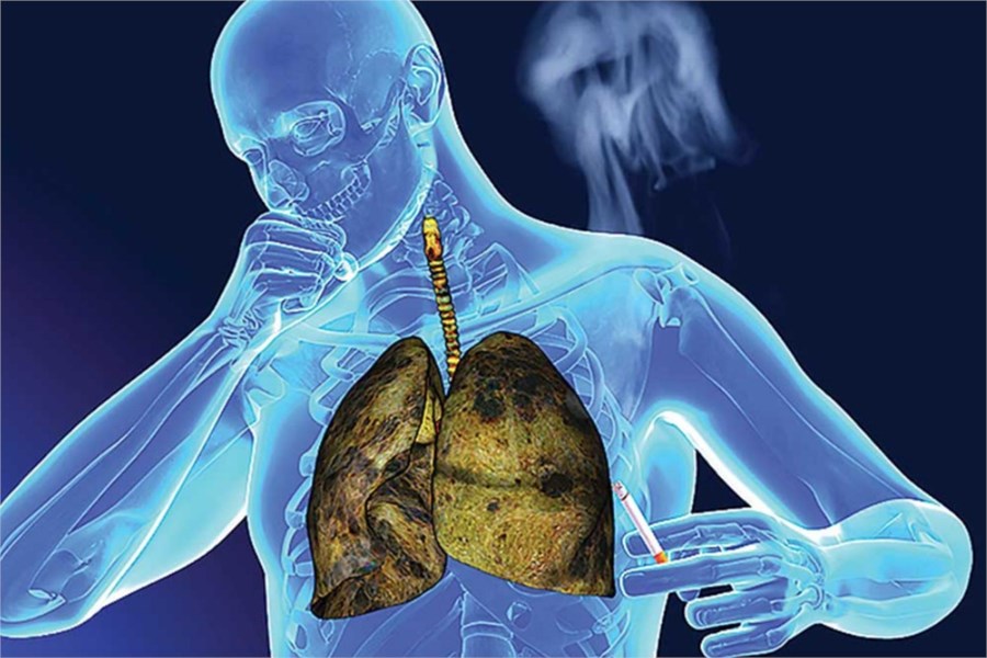Bác sĩ Bệnh viện K cảnh báo dấu hiệu cảnh báo ung thư phổi - 1