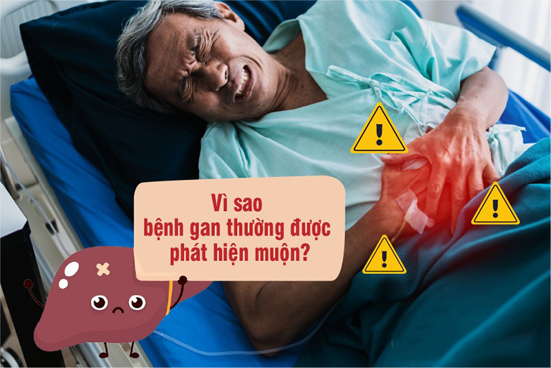 Cảnh báo: Nhiều người phát hiện bệnh gan khi đã ở giai đoạn nặng - 1