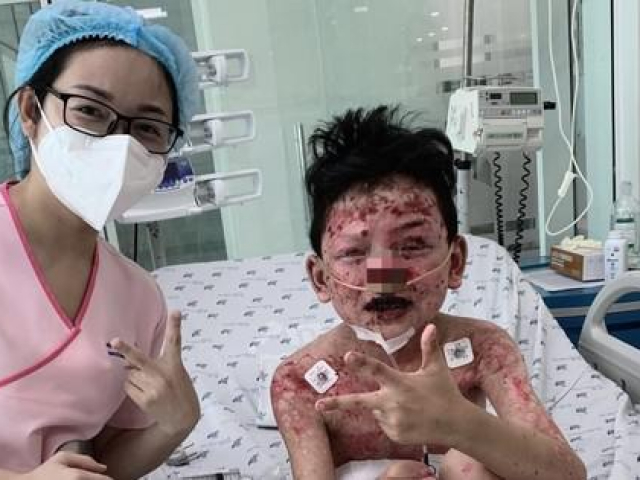 Sức khỏe đời sống - Bé trai "thập tử nhất sinh" sau khi ăn cua