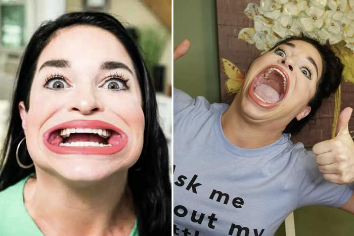 Người phụ nữ kiếm bộn tiền nhờ sở hữu chiếc miệng rộng lớn nhất thế giới. Ảnh: NY Post